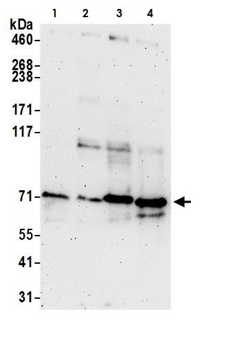 Western blot - Anti-ACSS2 antibody (AB264391)