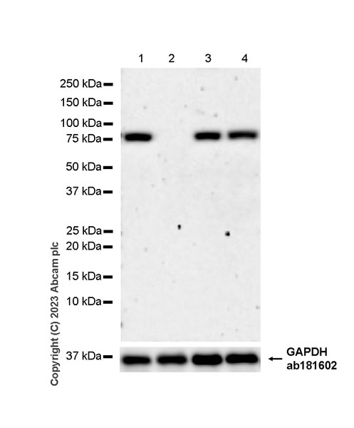 Western blot - Anti-ACSS2 antibody [EPR27496-4] - BSA and Azide free (AB314491), expandable thumbnail
