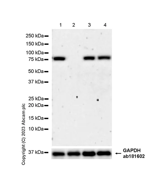 Western blot - Anti-ACSS2 antibody [EPR27496-4] - BSA and Azide free (AB314491)