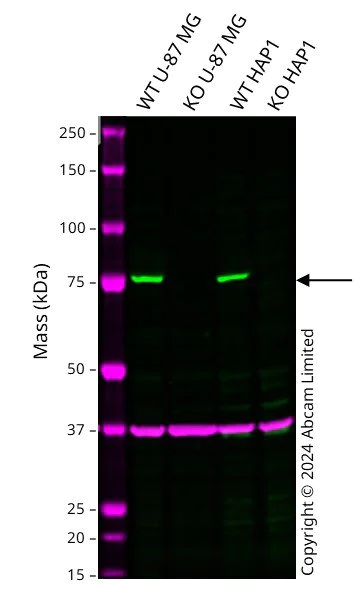 Western blot - Anti-ACSS2 antibody [EPR27496-4] - BSA and Azide free (AB314491)