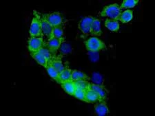 Immunocytochemistry/ Immunofluorescence - Anti-ACSS2 antibody [EPR8500] (AB133664)