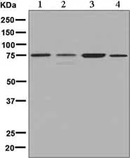 Western blot - Anti-ACSS2 antibody [EPR8500] (AB133664)