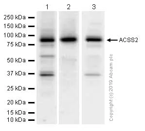 Western blot - Anti-ACSS2 antibody [EPR8500] (AB133664)