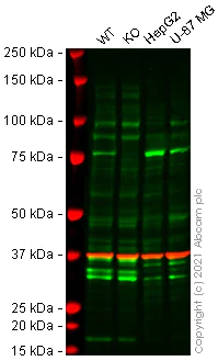 Western blot - Anti-ACSS2 antibody [EPR8500] (AB133664)