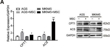 Western blot - Anti-ACSS2 antibody [EPR8500] (AB133664)