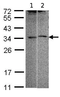 Western blot - Anti-ACT antibody (AB97396)