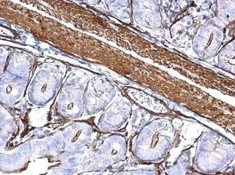Immunohistochemistry (Formalin/PFA-fixed paraffin-embedded sections) - Anti-ACTC1 antibody (AB151787)
