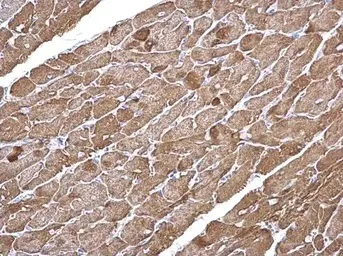 Immunohistochemistry (Formalin/PFA-fixed paraffin-embedded sections) - Anti-ACTC1 antibody (AB151787)