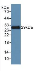 Western blot - Anti-ACTC1 antibody [C3] (AB239475)