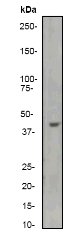 Western blot - Anti-ACTC1 antibody [EP184E] (AB46805)