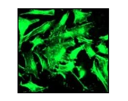 Immunocytochemistry/ Immunofluorescence - Anti-ACTC1 antibody [EP184E] - BSA and Azide free (AB247305)