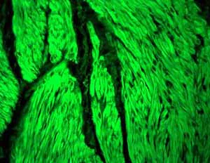 Immunohistochemistry (Formalin/PFA-fixed paraffin-embedded sections) - Anti-ACTC1 antibody [EP184E] - BSA and Azide free (AB247305)
