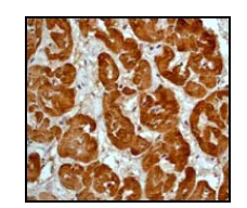 Immunohistochemistry (Formalin/PFA-fixed paraffin-embedded sections) - Anti-ACTC1 antibody [EP184E] - BSA and Azide free (AB247305)
