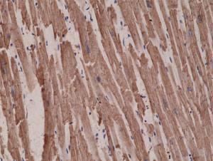 Immunohistochemistry (Formalin/PFA-fixed paraffin-embedded sections) - Anti-ACTC1 antibody [RM257] - N-terminal (AB218549), expandable thumbnail