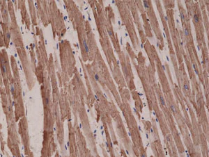 Immunohistochemistry (Formalin/PFA-fixed paraffin-embedded sections) - Anti-ACTC1 antibody [RM257] - N-terminal (AB218549)