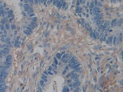 Immunohistochemistry (Formalin/PFA-fixed paraffin-embedded sections) - Anti-ACTG2 antibody (AB231802)