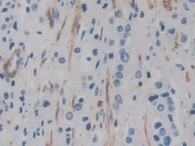 Immunohistochemistry (Formalin/PFA-fixed paraffin-embedded sections) - Anti-ACTG2 antibody (AB231802)