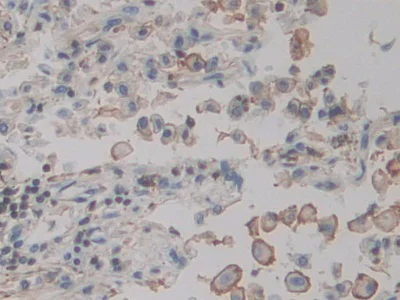 Immunohistochemistry (Formalin/PFA-fixed paraffin-embedded sections) - Anti-ACTG2 antibody (AB231802)