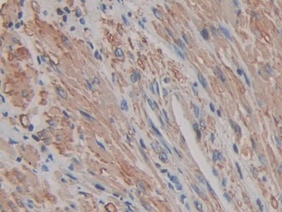 Immunohistochemistry (Formalin/PFA-fixed paraffin-embedded sections) - Anti-ACTG2 antibody (AB231802)