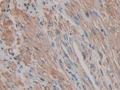 Immunohistochemistry (Formalin/PFA-fixed paraffin-embedded sections) - Anti-ACTG2 antibody (AB231802)