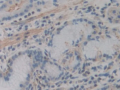Immunohistochemistry (Formalin/PFA-fixed paraffin-embedded sections) - Anti-ACTG2 antibody (AB231802)