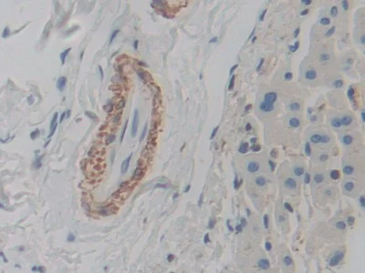 Immunohistochemistry (Formalin/PFA-fixed paraffin-embedded sections) - Anti-ACTG2 antibody (AB231802)
