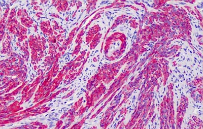 Immunohistochemistry (Formalin/PFA-fixed paraffin-embedded sections) - Anti-ACTG2 antibody - N-terminal (AB189385)