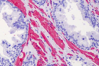 Immunohistochemistry (Formalin/PFA-fixed paraffin-embedded sections) - Anti-ACTG2 antibody - N-terminal (AB189385)
