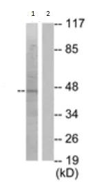 Western blot - Anti-ACTG2 antibody - N-terminal (AB189385)