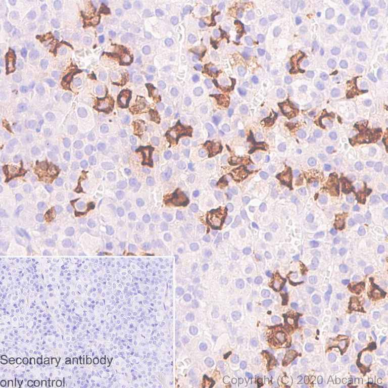 Immunohistochemistry (Formalin/PFA-fixed paraffin-embedded sections) - Anti-ACTH antibody [57] - N-terminal (AB233954)