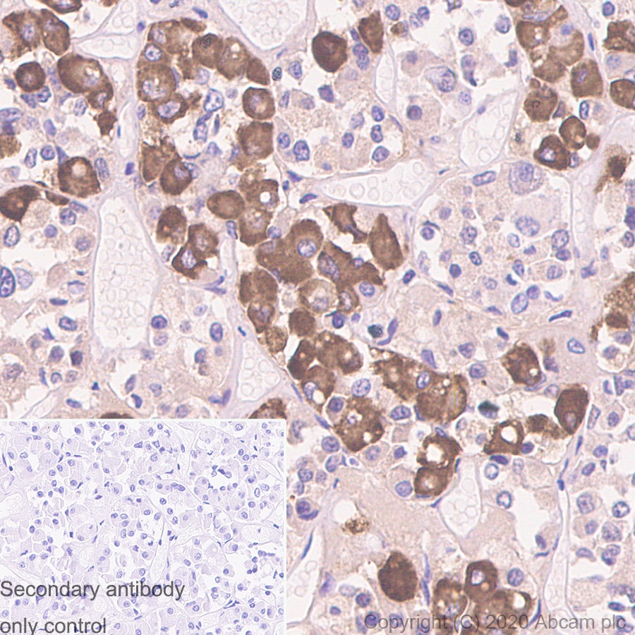 Immunohistochemistry (Formalin/PFA-fixed paraffin-embedded sections) - Anti-ACTH antibody [57] - N-terminal (AB233954)