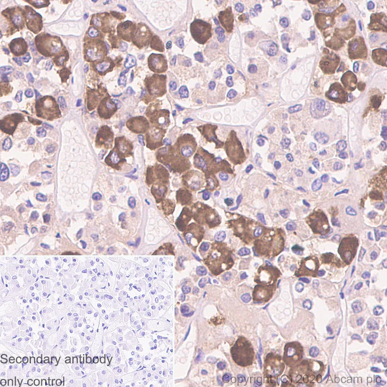 Immunohistochemistry (Formalin/PFA-fixed paraffin-embedded sections) - Anti-ACTH antibody [57] - N-terminal (AB233954)
