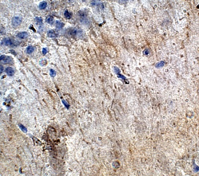Immunohistochemistry (Formalin/PFA-fixed paraffin-embedded sections) - Anti-ACTH antibody (AB74976)