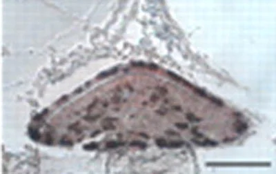 Immunohistochemistry (Formalin/PFA-fixed paraffin-embedded sections) - Anti-ACTH antibody (AB74976)