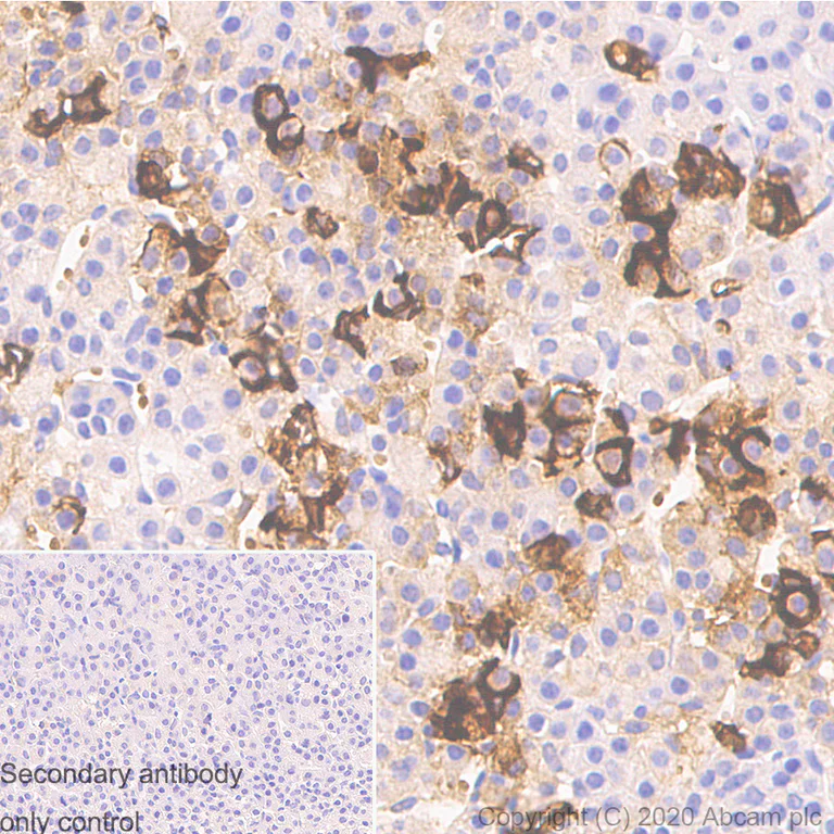 Immunohistochemistry (Formalin/PFA-fixed paraffin-embedded sections) - Anti-ACTH antibody [AH26] (AB233953)