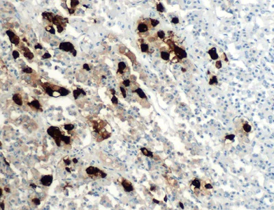 Immunohistochemistry (Formalin/PFA-fixed paraffin-embedded sections) - Anti-ACTH antibody [SPM501] (AB231425)