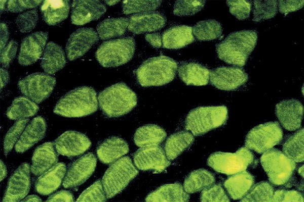Immunohistochemistry (Frozen sections) - Anti-Actin antibody [AC-40] - Loading Control (AB11003), expandable thumbnail