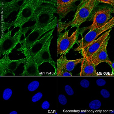 Immunocytochemistry/ Immunofluorescence - Anti-Actin antibody [EPR16769] (AB179467), expandable thumbnail
