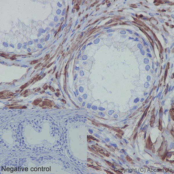 Immunohistochemistry (Formalin/PFA-fixed paraffin-embedded sections) - Anti-Actin antibody [EPR16769] - Loading Control (AB179467), expandable thumbnail