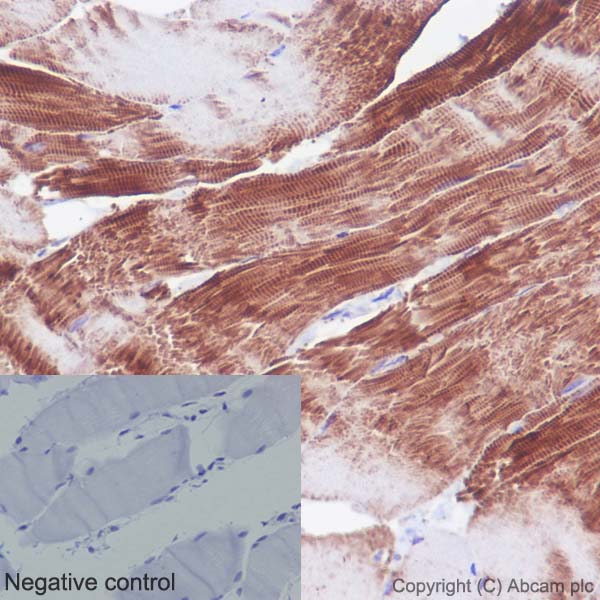 Immunohistochemistry (Formalin/PFA-fixed paraffin-embedded sections) - Anti-Actin antibody [EPR16769] (ab179467), expandable thumbnail