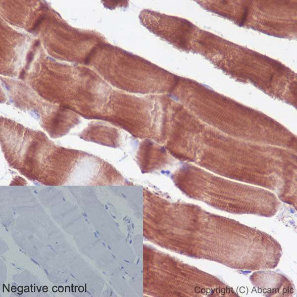 Immunohistochemistry (Formalin/PFA-fixed paraffin-embedded sections) - Anti-Actin antibody [EPR16769] (AB179467), expandable thumbnail
