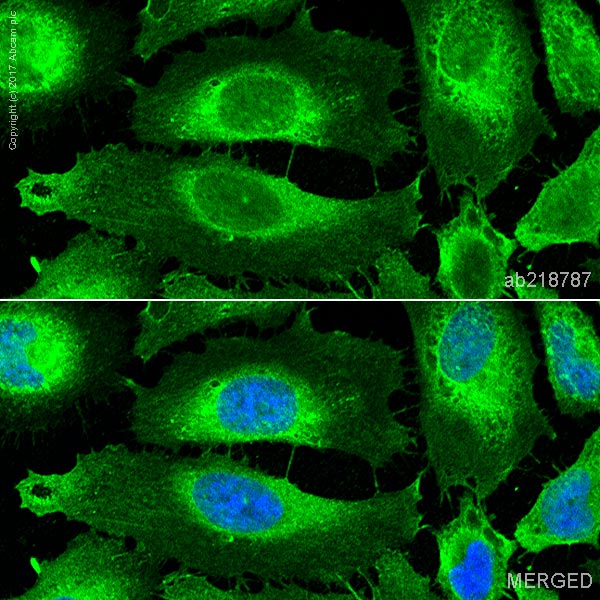 Immunocytochemistry/ Immunofluorescence - Anti-Actin antibody [IGX3831R-3] (AB218787), expandable thumbnail