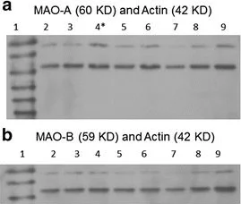 Western blot - Anti-Actin antibody - Loading Control (AB1801)