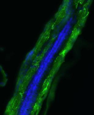 Immunohistochemistry - Anti-Actin antibody (AB209857), expandable thumbnail