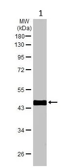 Western blot - Anti-Actin antibody - Loading Control (AB209857)
