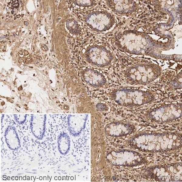Immunohistochemistry (Formalin/PFA-fixed paraffin-embedded sections) - Anti-Actin antibody [mAbGEa] (AB230169), expandable thumbnail