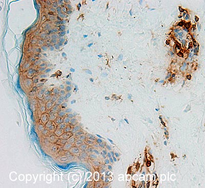 Immunohistochemistry (Formalin/PFA-fixed paraffin-embedded sections) - Anti-Actin antibody [MAC 237] - Cytoskeleton marker (AB50591), expandable thumbnail