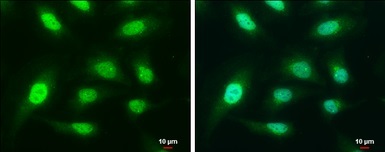 Immunocytochemistry/ Immunofluorescence - Anti-Actin Regulatory Protein CAPG/MCP antibody (AB155688)