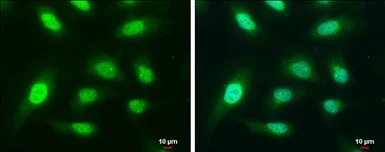 Immunocytochemistry/ Immunofluorescence - Anti-Actin Regulatory Protein CAPG/MCP antibody (AB155688)