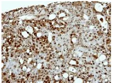 Immunohistochemistry (Formalin/PFA-fixed paraffin-embedded sections) - Anti-Actin Regulatory Protein CAPG/MCP antibody (AB155688)
